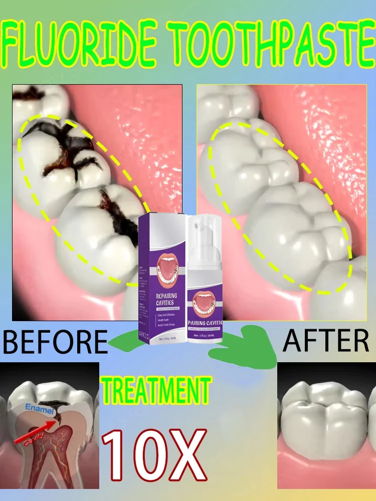 Teeth Whitening That Works - Heiße Verkäufe Bestseller, wissenschaftlich repariert Hohlräume,