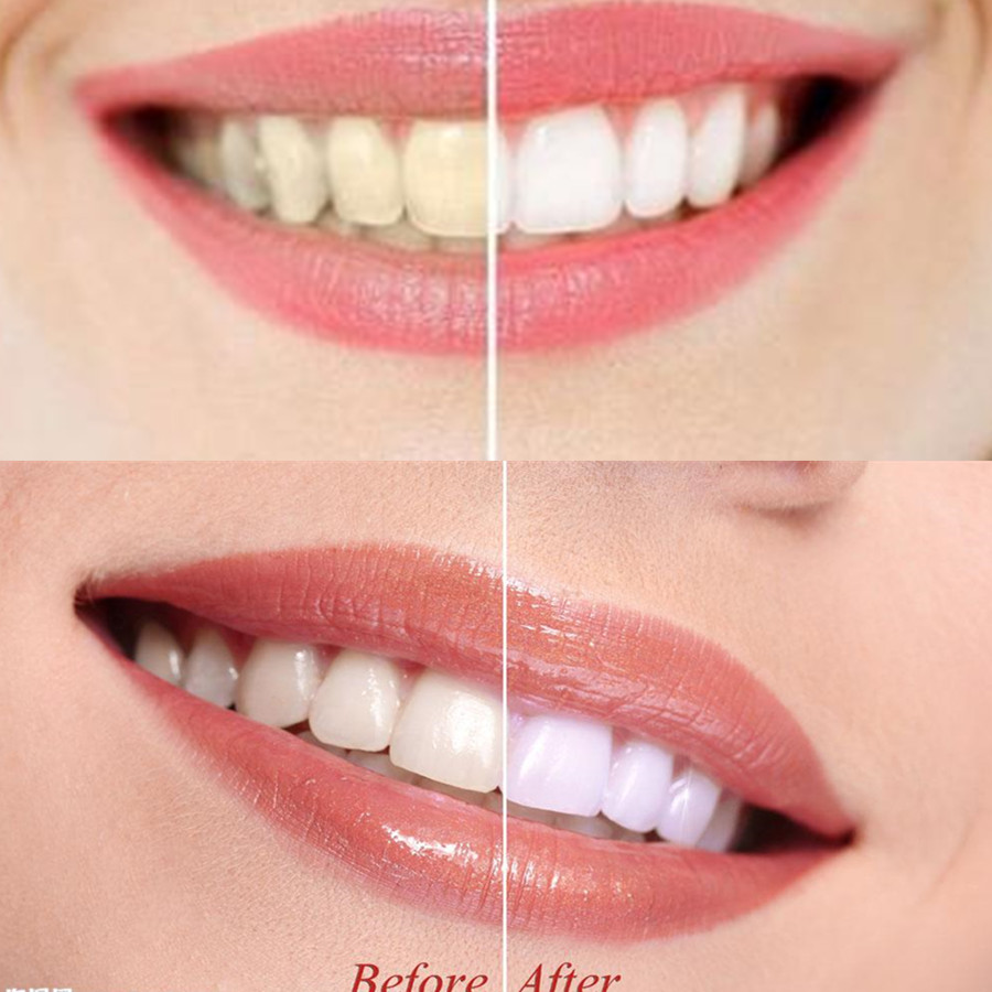 Bambus Holzkohle Zähne Zahn De – Teeth Whitening Instant Bewertung und Preis