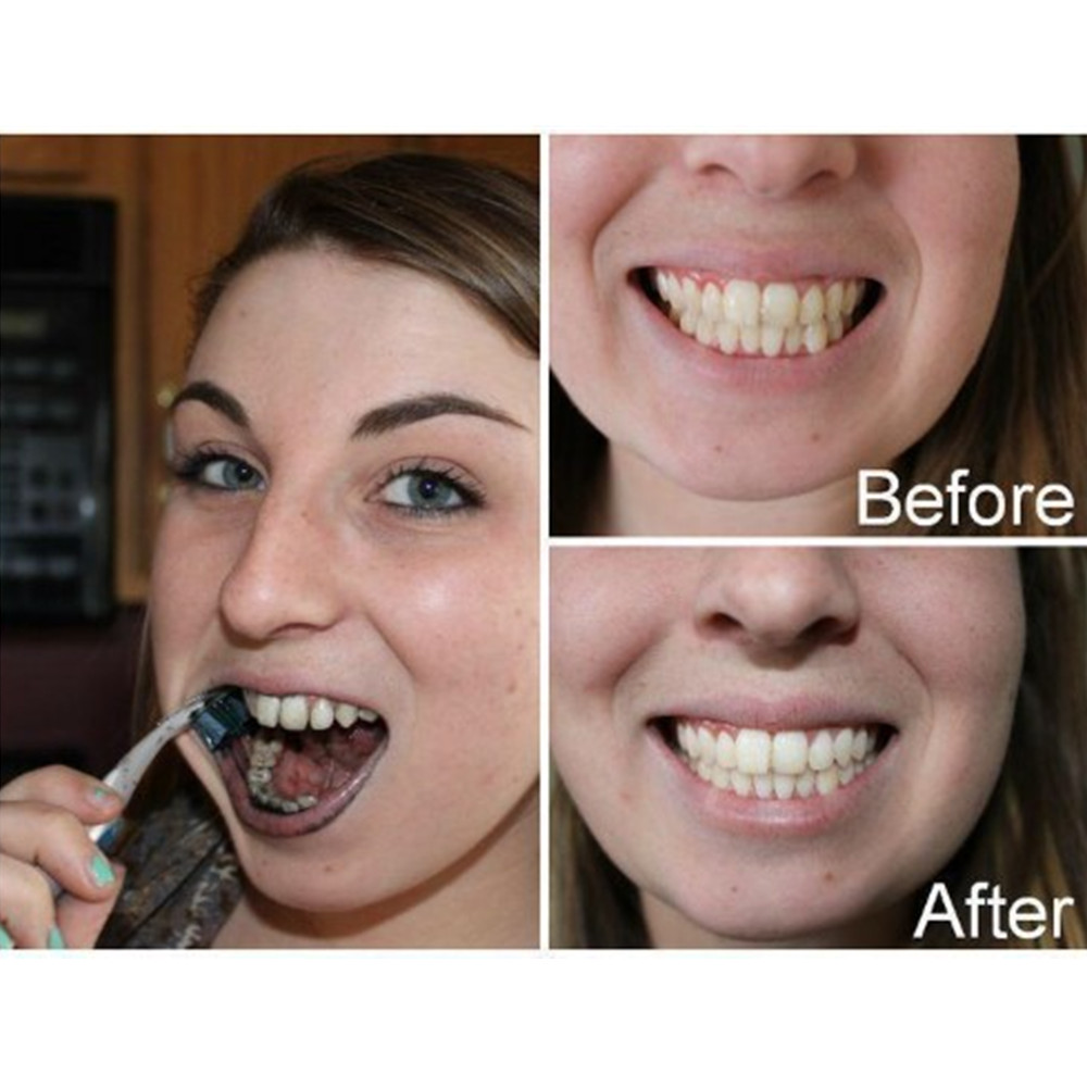 Bambus Holzkohle Zähne Zahn De – Teeth Whitening Instant Bewertung und Preis