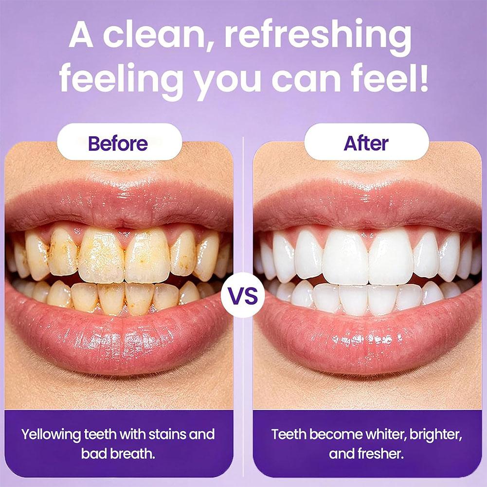 Lila Farbkorrigierende Zahnauf – Teeth Whitening Instant Bewertung und Preis
