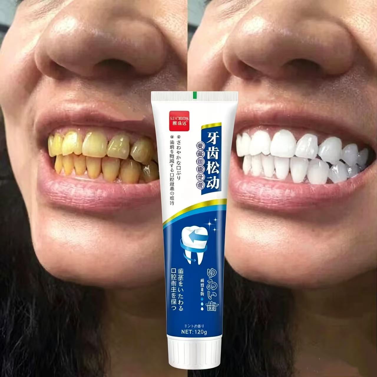 Japanische Import-Zahnpasta ge – Teeth Whitening Japan Bewertung und Preis