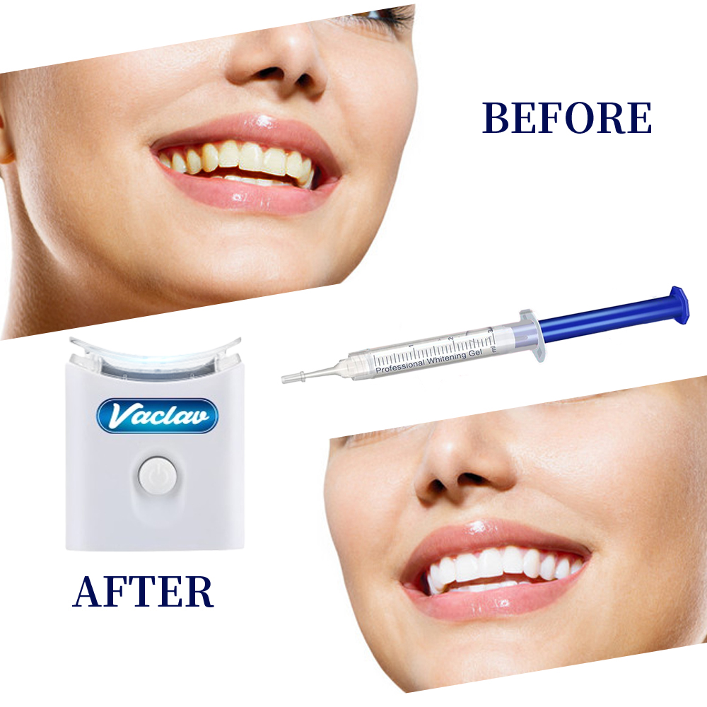 Minze Zähne Bleaching Gel Spri – Teeth Whitening Gel Syringes Bewertung und Preis