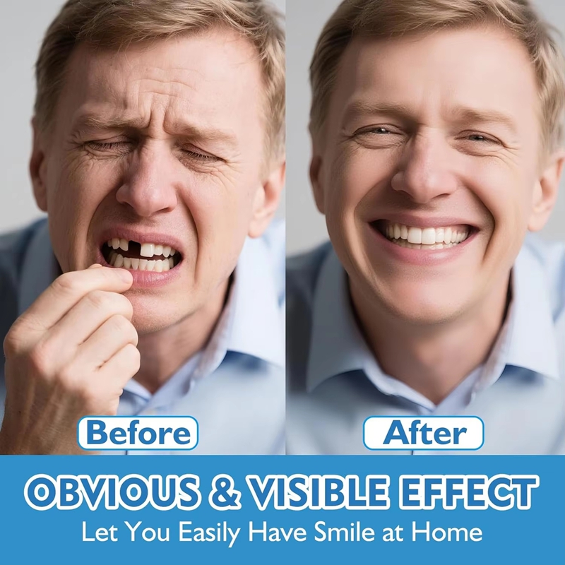 Komplettes Silikon-Zahnprothes – Teeth Whitening Instant Bewertung und Preis