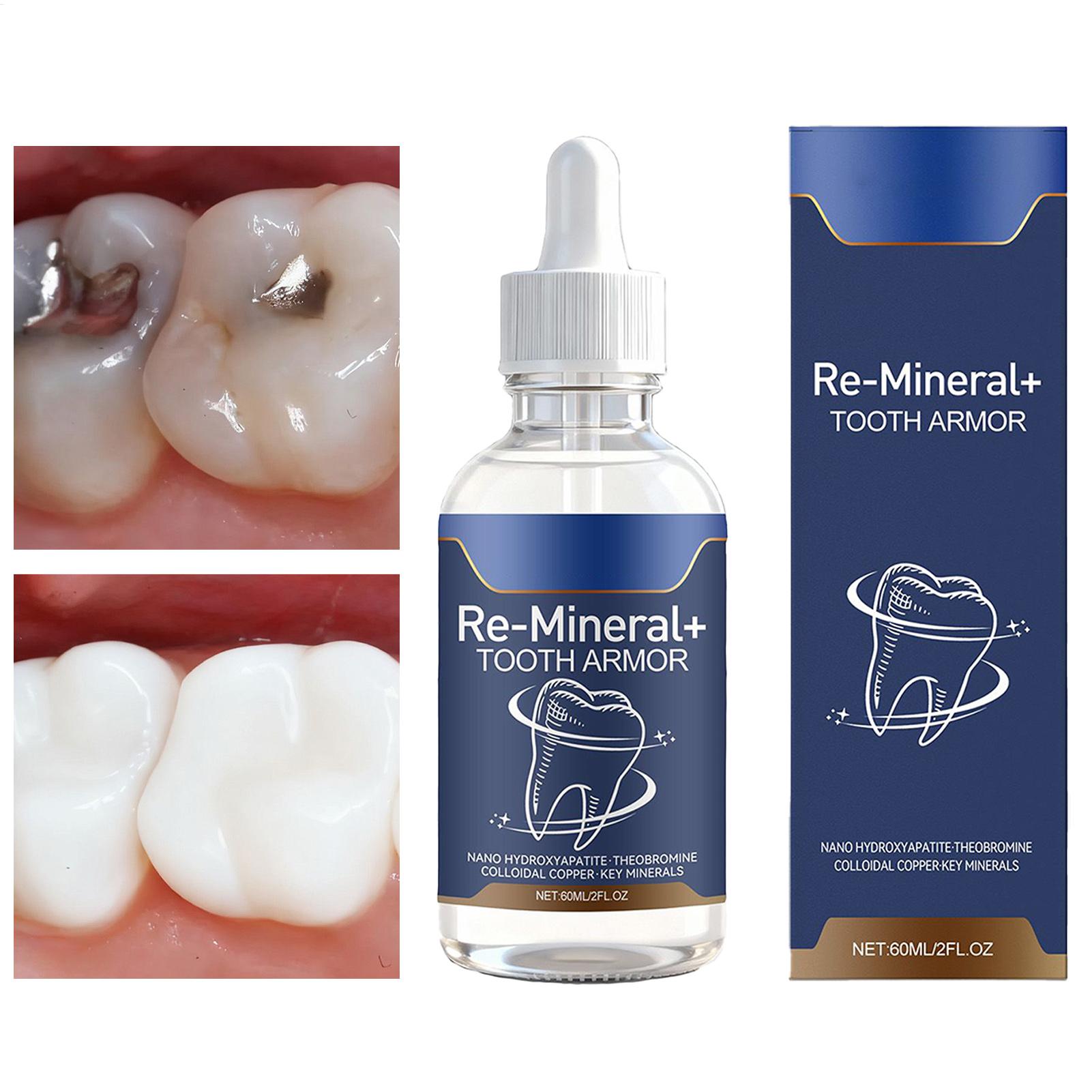 60 ml Zahnreinigungsflüssigkei – Teeth Whitening Gum Bewertung und Preis