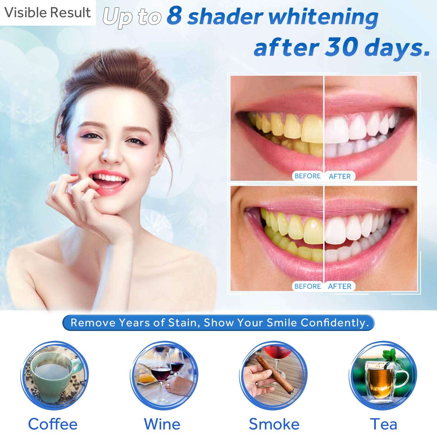 Zahnaufhellungsgel, Nachfüllsp – Teeth Whitening Gels Bewertung und Preis