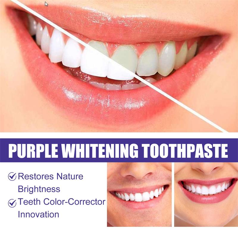 9D Lila Zahnaufhellungs-Zahnpa – Teeth Whitening That Works Bewertung und Preis