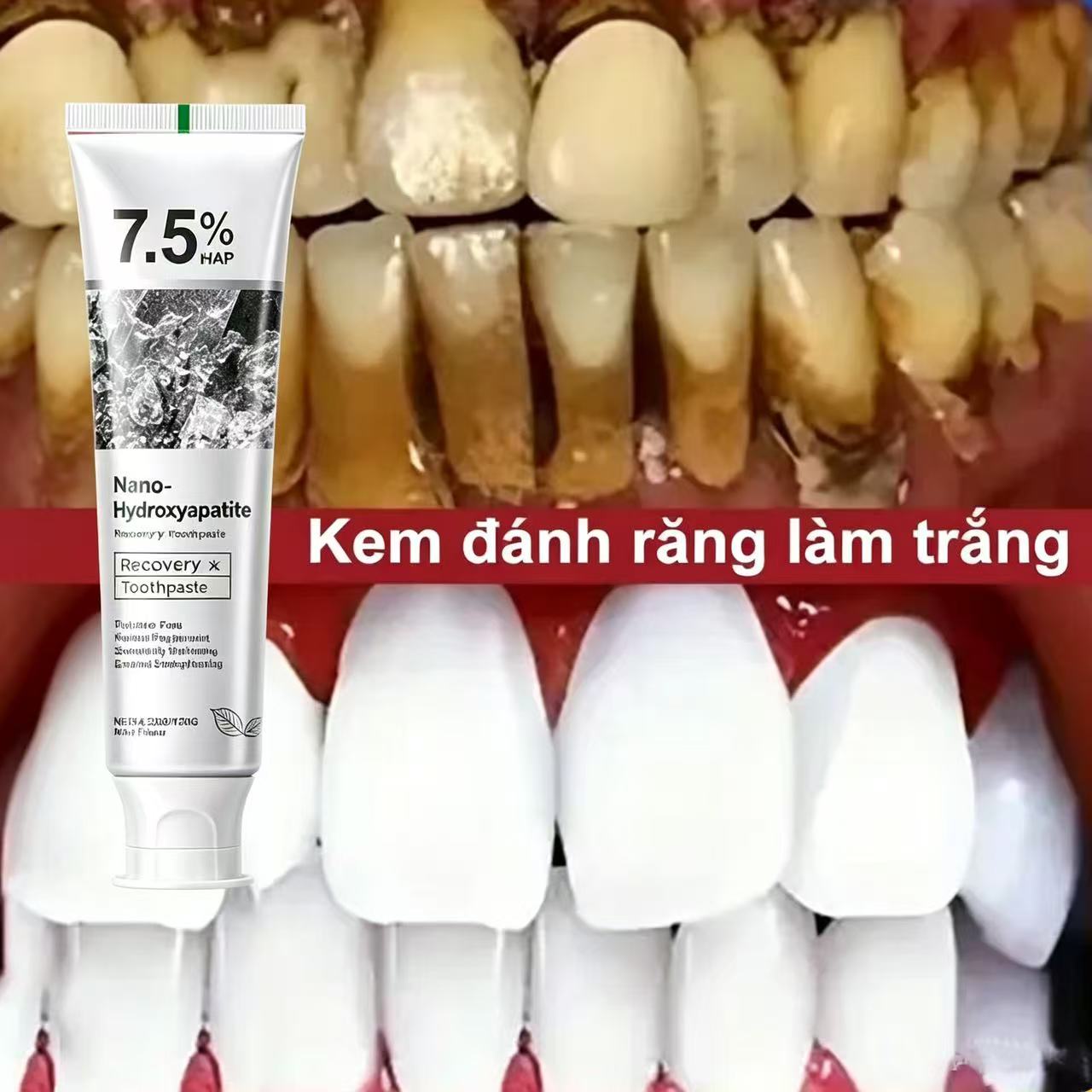 7,5% Hydroxyapatit Probiotisch – Teeth Whitening That Works Bewertung und Preis