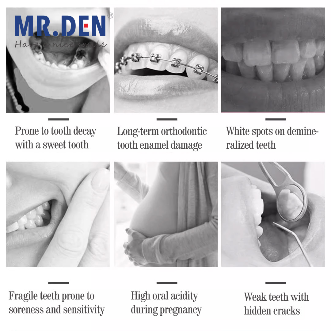 Japan GC Fluorid Enhanced Dent – Teeth Whitening Japan Bewertung und Preis