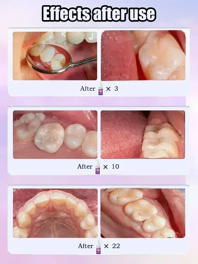 Zahnreinigung Zahnpasta Entfer – Teeth Whitening That Works Bewertung und Preis