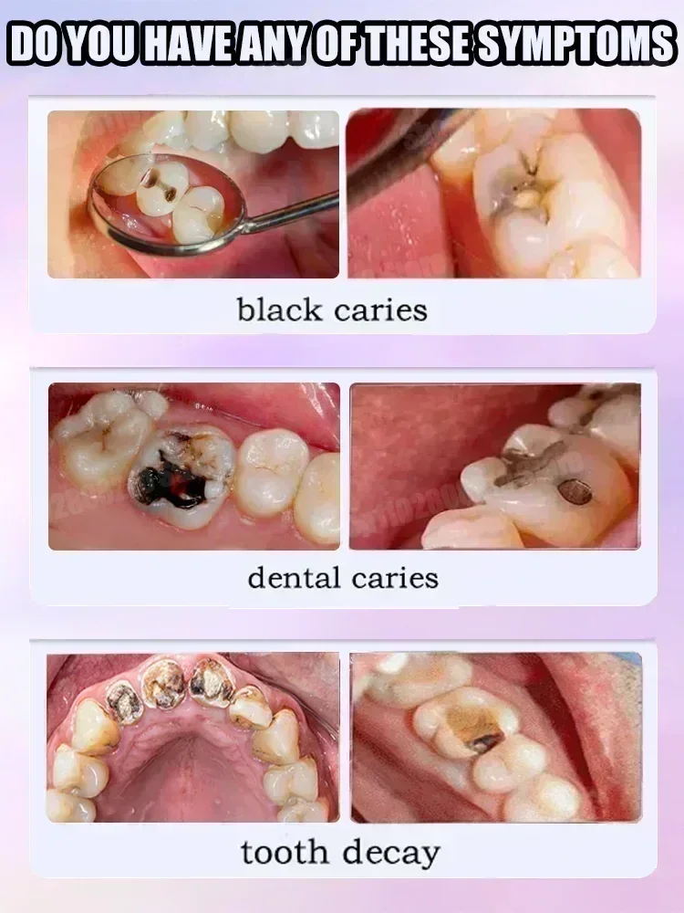 Zahnreinigung Zahnpasta Entfer – Teeth Whitening That Works Bewertung und Preis